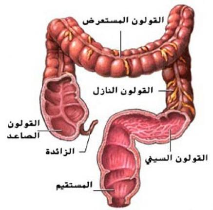 الام القولون