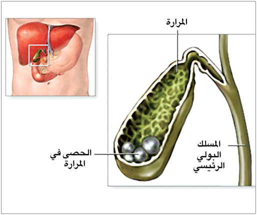 الم المرارة