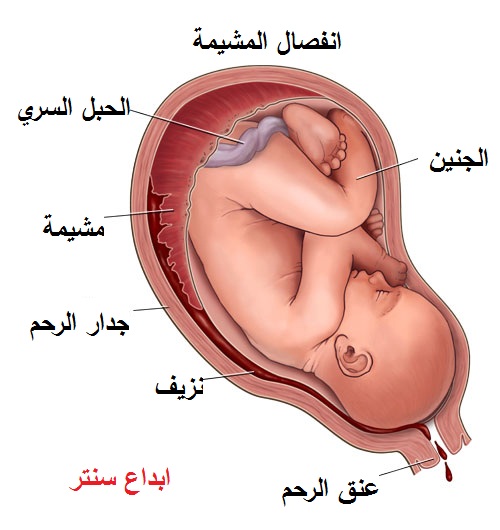 الم اسفل البطن للحامل في الشهر الثامن ، اسبابه و كيف تتخلصين منه في ثواني 14210 1