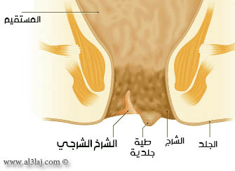 الشرخ الشرجي