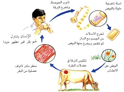 الديدان عند الاطفال بالصور 11563