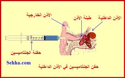 مخدر موضعي طبيعي 353261911D15668E3E0B7Ddfa4Cfae2A