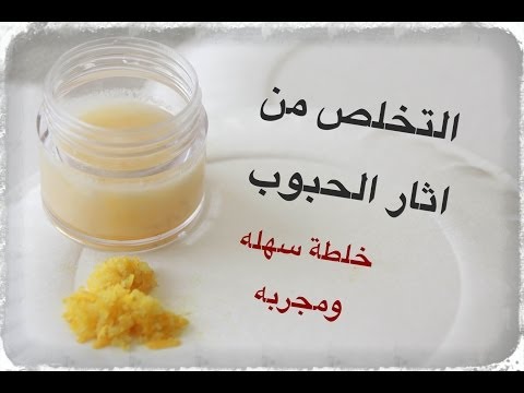 الكريم دة شال الحبوب واثارها كلها - كريم لازالة اثار الحبوب من الوجه نهائيا 12826