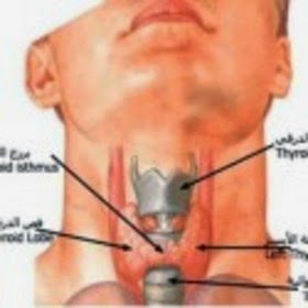 نشاط الغدة الدرقية وعلاجها بالاعشاب Caaabfc2E5A3462979Bc4C8A0Ec1Bbe5