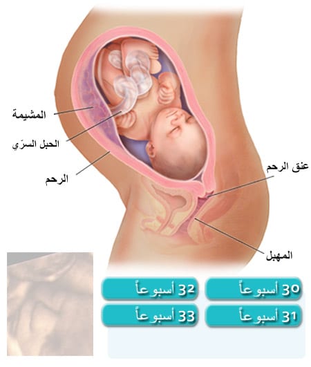 وضع الجنين في الشهر السابع