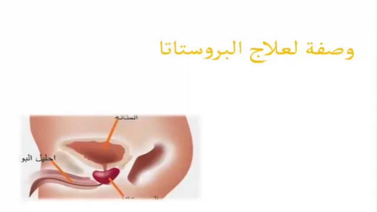 علاج البروستاتا , الاعشاب لعلاج البروستاتا