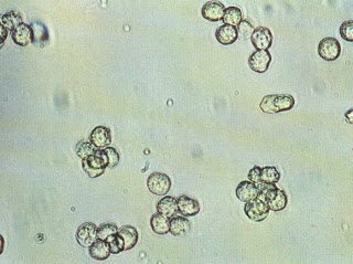 pus cells المعدل الطبيعي