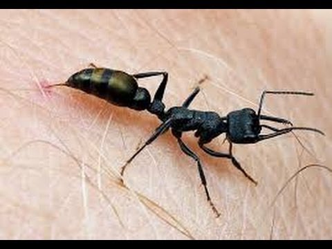 علاج قرصة النملة السوداء افضل كيف